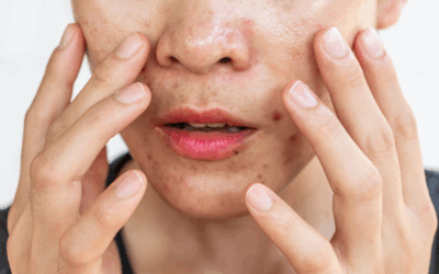 Routine Minimaliste Peau grasse : L’Essentiel à connaitre.