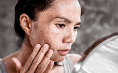 Routine anti-tâches en 5 étapes : Adieu à l’hyperpigmentation.