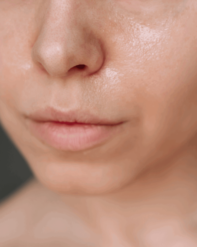 L'effet Glass skin recherché par les utilisateurs des PDRN