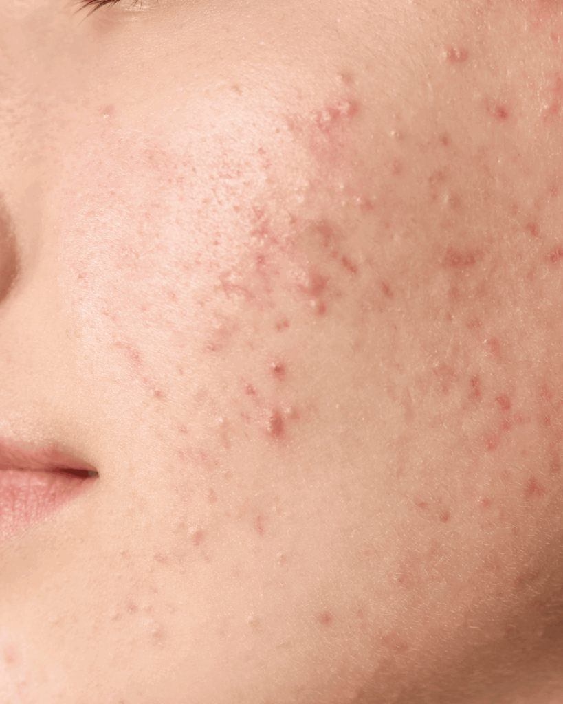 L'effet rebond après l'été.