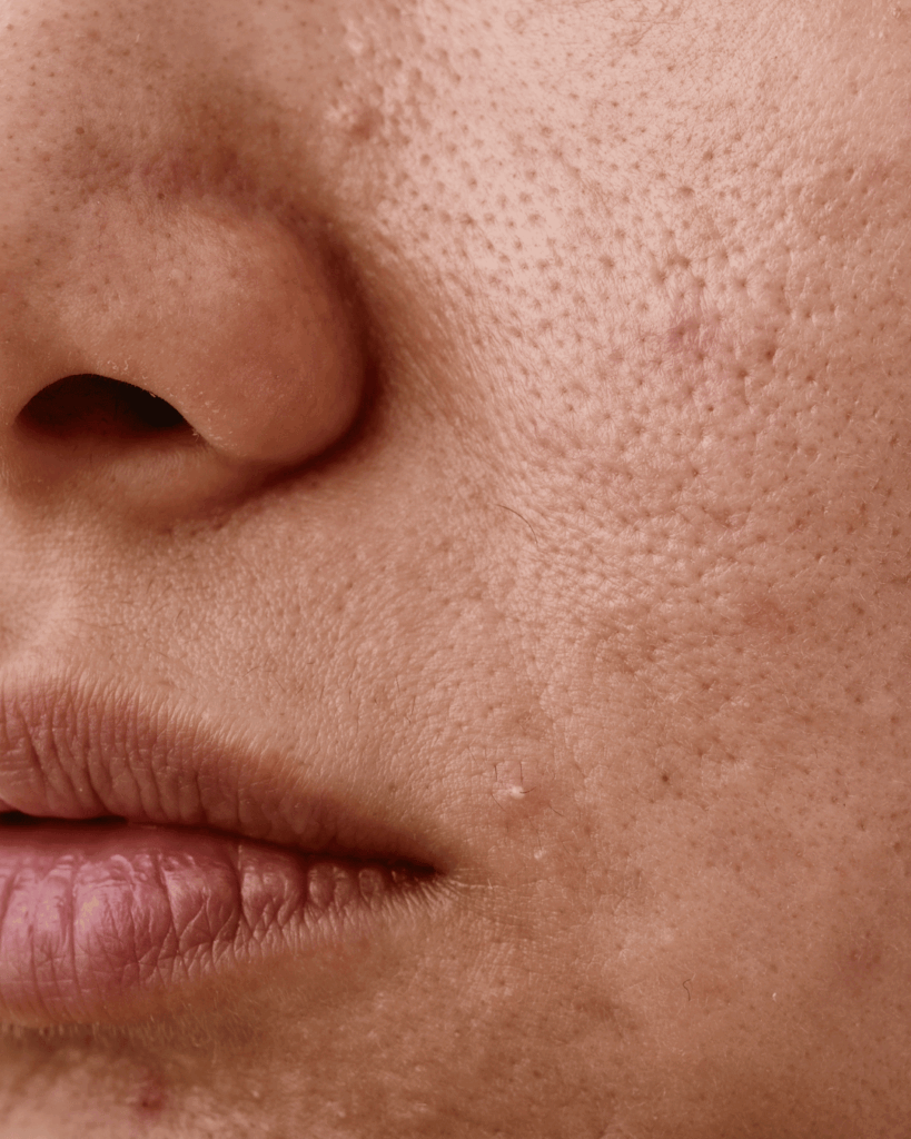 Associer deux produits avec les mêmes principes actifs est une mauvaise idée pour vos soins de la peau.