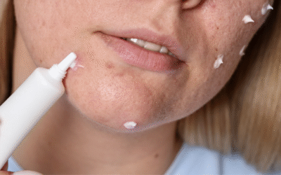 Soufre, l’Arme Secrète Anti-Imperfections